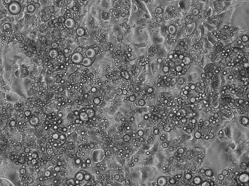 Figura 3: Diferenciación de células nai mesenquimais a adipocitos.