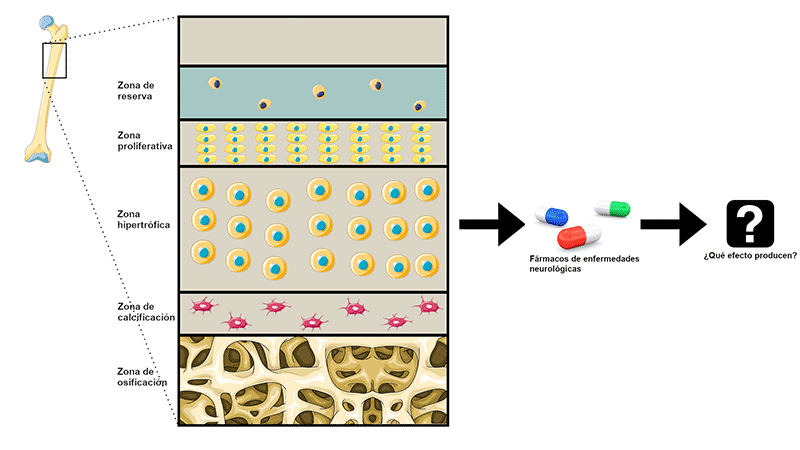 Schematic image of the long bone growth plate